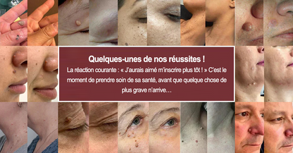 💖Patch 2-en-1 Curalona® : Microneedle & Hydrocolloïde🍀 | Élimine les grains de beauté en relief, les verrues planes et les acrochordons | Aide à atténuer les rides, les cicatrices et les imperfections | Patch invisible adapté au visage et au corps