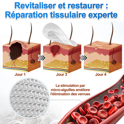 💖Patch 2-en-1 Curalona® : Microneedle & Hydrocolloïde🍀 | Élimine les grains de beauté en relief, les verrues planes et les acrochordons | Aide à atténuer les rides, les cicatrices et les imperfections | Patch invisible adapté au visage et au corps