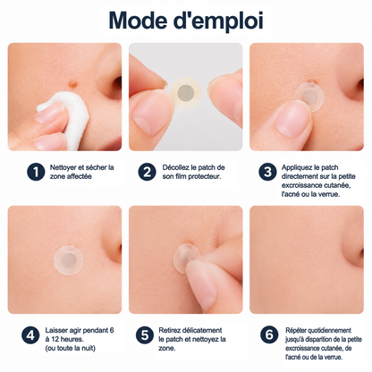 💖Patch 2-en-1 Curalona® : Microneedle & Hydrocolloïde🍀 | Élimine les grains de beauté en relief, les verrues planes et les acrochordons | Aide à atténuer les rides, les cicatrices et les imperfections | Patch invisible adapté au visage et au corps