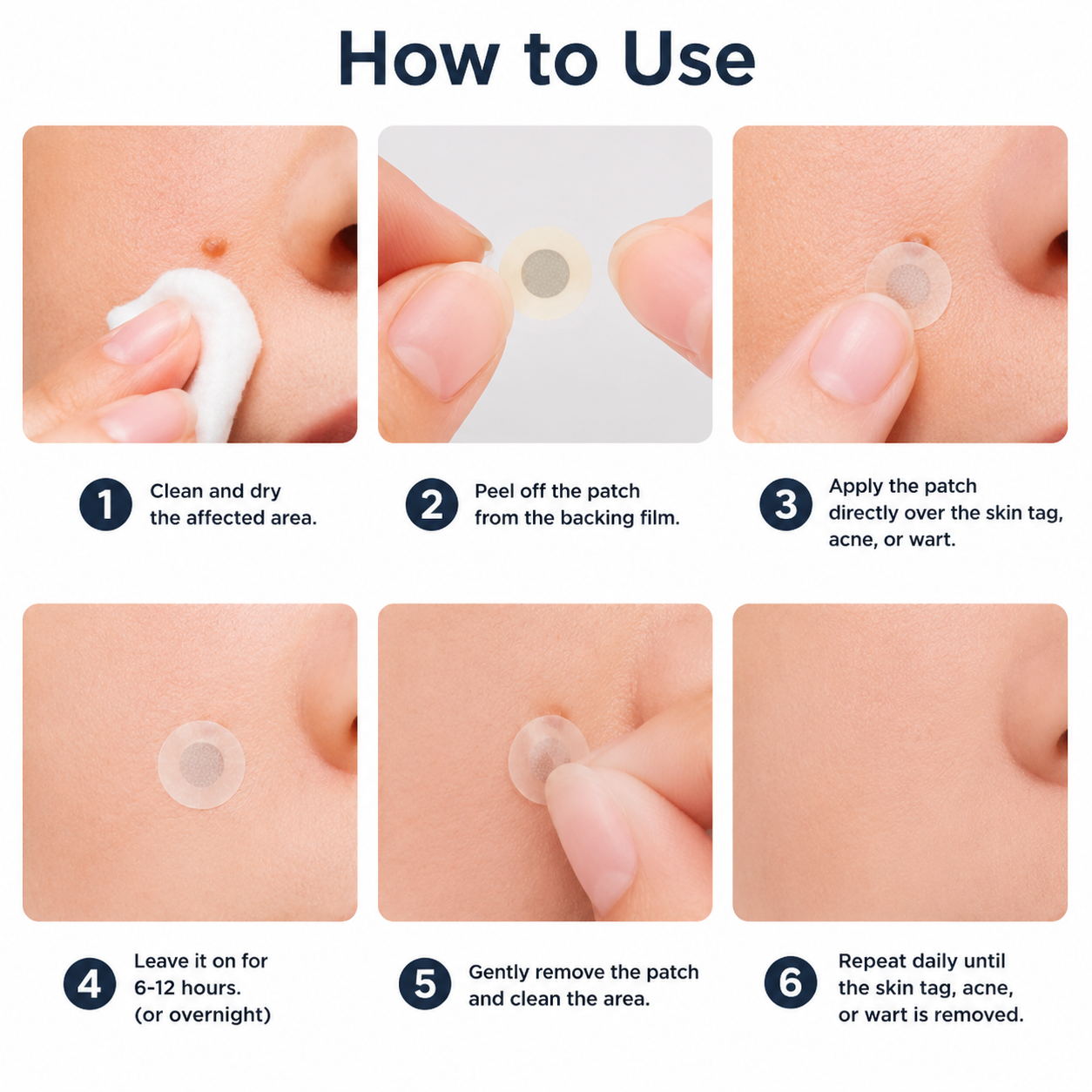 🏥Patch 2-en-1 Curalona® : Microneedle & Hydrocolloïde🏥 | Élimine les grains de beauté en relief, les verrues planes et les acrochordons | Aide à atténuer les rides, les cicatrices et les imperfections | Patch invisible adapté au visage et au corps