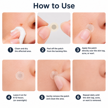 🏥Patch 2-en-1 Curalona® : Microneedle & Hydrocolloïde🏥 | Élimine les grains de beauté en relief, les verrues planes et les acrochordons | Aide à atténuer les rides, les cicatrices et les imperfections | Patch invisible adapté au visage et au corps