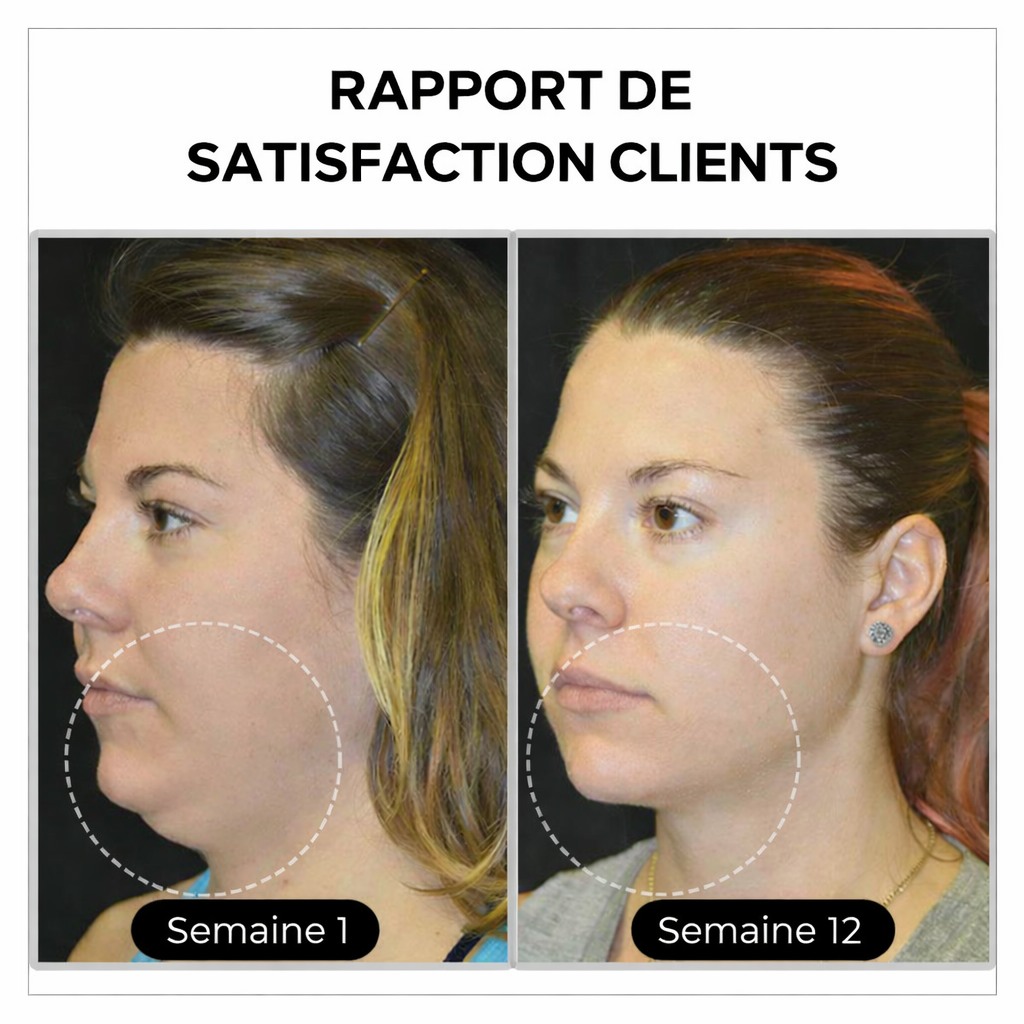 (🔥 DERNIER JOUR – SOLDES 80%)💎 Czticle® Histone Magnetology Lymphvity Boucles d’Oreilles en Germanium