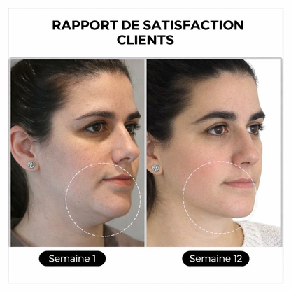 (🔥 DERNIER JOUR – SOLDES 80%)💎 Czticle® Histone Magnetology Lymphvity Boucles d’Oreilles en Germanium