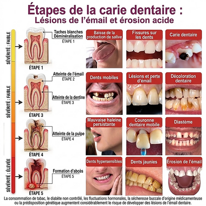Purelora® DenPerm – Gel de comblement de l’émail naturel pour la réparation des caries